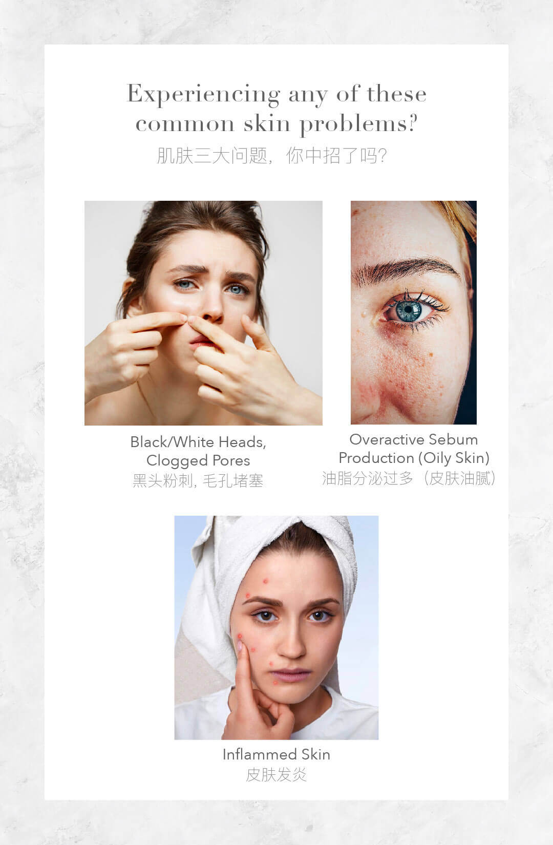 purifying series web info oil free 5